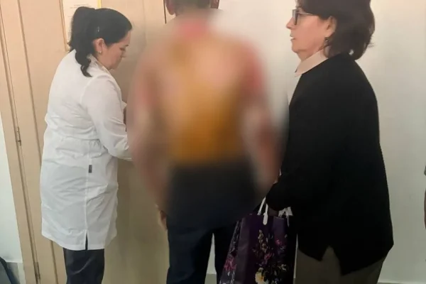 Подросток, пострадавший после поджога в красноярской школе, все еще в реанимации