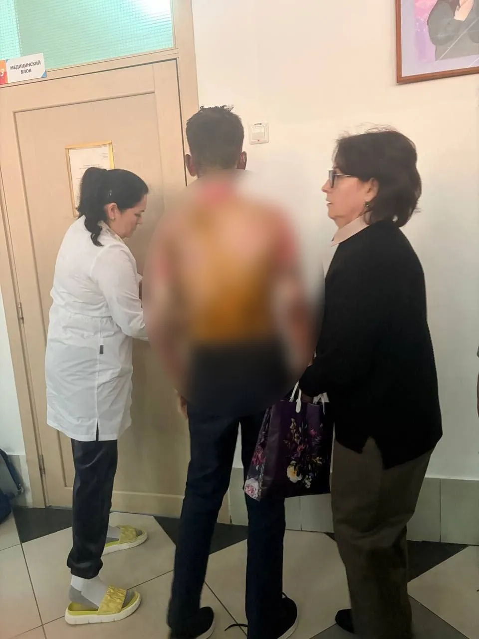 Подросток, пострадавший после поджога в красноярской школе, все еще в реанимации