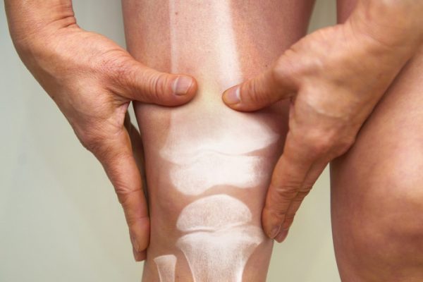 Врач Калинский назвал лишний вес врагом суставов