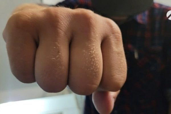 В Астрахани подросток ограбил и избил ребёнка